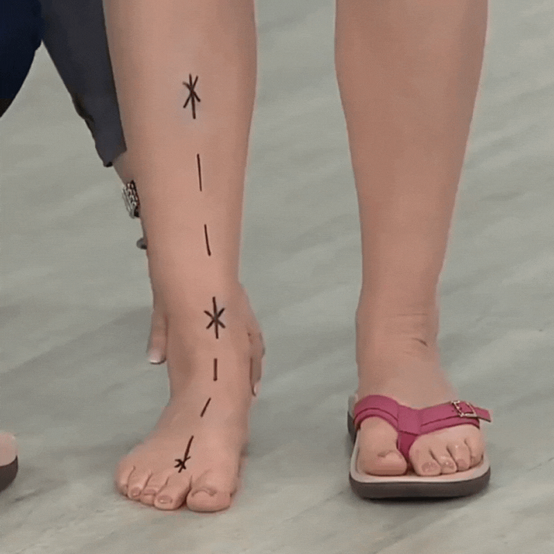 Stilla | Ortopediske Sommer Basic Sandaler